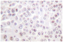 H2BFS, Rabbit, Polyclonal Antibody, Abnova 100&mu;L; Unlabeled:Antibodies,