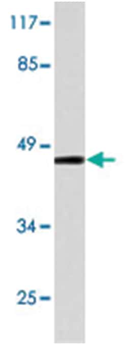RAD52 Rabbit anti-Human, Mouse, Polyclonal Antibody, Abnova 100&mu;L; Unlabeled:Antibodies,