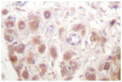 RAD52 Rabbit anti-Human, Mouse, Polyclonal Antibody, Abnova 100&mu;L; Unlabeled:Antibodies,