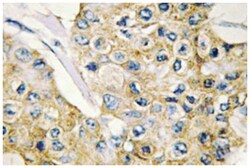 DAPP1, Rabbit, Polyclonal Antibody, Abnova 100&mu;L; Unlabeled:Antibodies,
