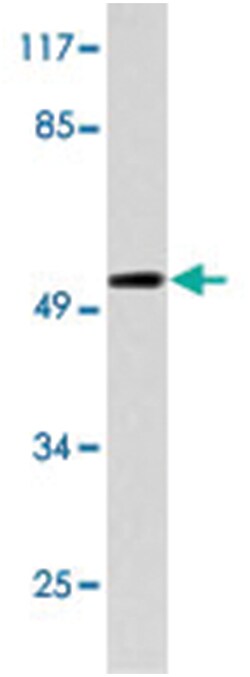 FOXO4 Rabbit anti-Human, Mouse, Polyclonal Antibody, Abnova 100 &mu;L | Buy Online | Abnova | Fisher Scientific
