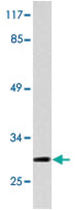 SNAI1 Rabbit anti-Human, Mouse, Polyclonal Antibody, Abnova 100&mu;L; Unlabeled:Antibodies,