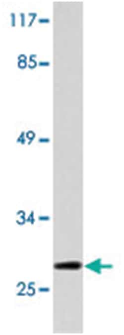 HOXB9, Rabbit, Polyclonal Antibody, Abnova 100 &mu;L | Buy Online | Abnova | Fisher Scientific