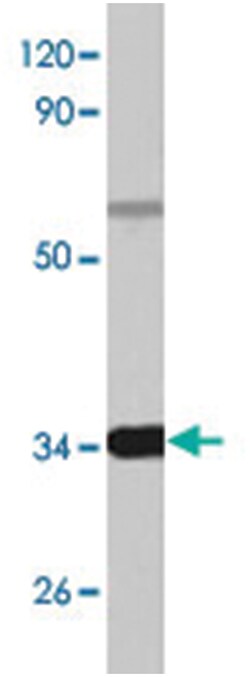CEBPB Rabbit anti-Human, Mouse, Polyclonal Antibody, Abnova 100&mu;L; Unlabeled:Antibodies,