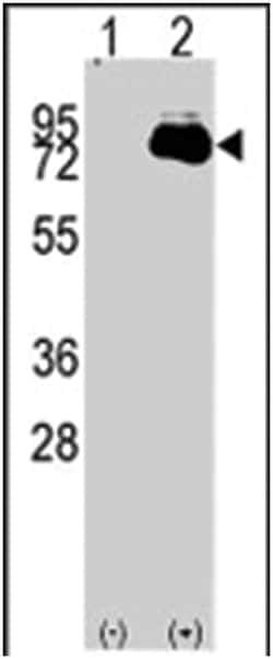 NUAK2, Rabbit, Polyclonal Antibody, Abnova 400 &mu;L | Buy Online | Abnova | Fisher Scientific