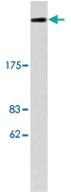 SPTBN1 Rabbit anti-Human, Mouse, Polyclonal Antibody, Abnova 100&mu;L;