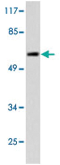 FYN Rabbit anti-Human, Mouse, Polyclonal Antibody, Abnova 100&mu;L; Unlabeled:Antibodies,