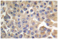 FYN Rabbit anti-Human, Mouse, Polyclonal Antibody, Abnova 100&mu;L; Unlabeled:Antibodies,