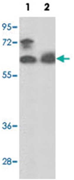 PANK1 Rabbit anti-Human, Mouse, Polyclonal Antibody, Abnova 400&mu;L; Unlabeled:Antibodies,