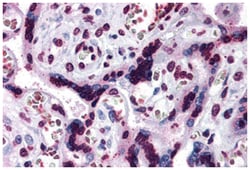 CARD14, Rabbit, Polyclonal Antibody, Abnova 100&mu;g; Unlabeled:Antibodies,