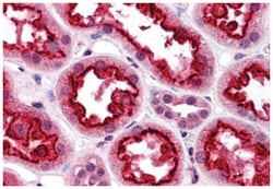 MAP3K7IP3 Rabbit anti-Human, Polyclonal Antibody, Abnova 100 &mu;g | Buy Online | Abnova | Fisher Scientific