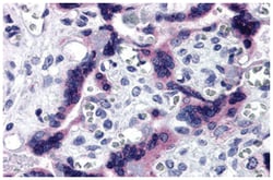 TTBK2, Rabbit, Polyclonal Antibody, Abnova 100&mu;g; Unlabeled:Antibodies,