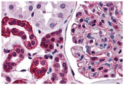 ZNF521 Rabbit anti-Human, Polyclonal Antibody, Abnova 100 &mu;g | Buy Online | Abnova Corporation | Fisher Scientific