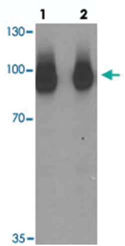 SARM1 Rabbit anti-Human, Mouse, Rat, Polyclonal Antibody, Abnova 100 &mu;g | Buy Online | Abnova Corporation | Fisher Scientific