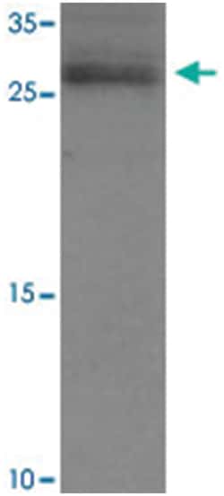 RAB21, Rabbit, Polyclonal Antibody, Abnova 100 &mu;g | Buy Online | Abnova Corporation | Fisher Scientific