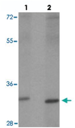 VAMP7, Rabbit, Polyclonal Antibody, Abnova 100&mu;g; Unlabeled:Antibodies,