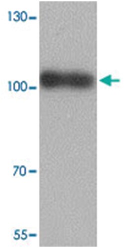 TRIM28, Rabbit, Polyclonal Antibody, Abnova 100&mu;g; Unlabeled:Antibodies,