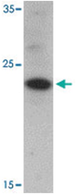 CHCHD6 Rabbit anti-Human, Polyclonal Antibody, Abnova 100 &mu;g | Buy Online | Abnova Corporation | Fisher Scientific
