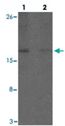 CHCHD7, Rabbit, Polyclonal Antibody, Abnova 100 &mu;g | Buy Online | Abnova Corporation | Fisher Scientific