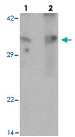 GRINA Rabbit anti-Human, Polyclonal Antibody, Abnova 100 &mu;g | Buy Online | Abnova Corporation | Fisher Scientific
