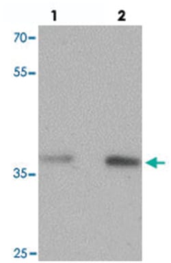 MECR, Rabbit, Polyclonal Antibody, Abnova 100&mu;g; Unlabeled:Antibodies,