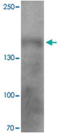 CRB1, Rabbit, Polyclonal Antibody, Abnova 100 &mu;g | Buy Online | Abnova Corporation | Fisher Scientific