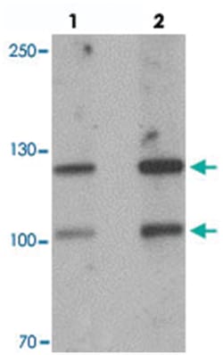 CRB2 Rabbit anti-Human, Mouse, Polyclonal Antibody, Abnova 100 &mu;g | Buy Online | Abnova Corporation | Fisher Scientific