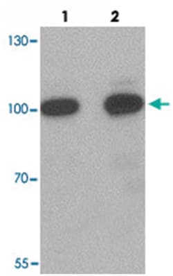 SIDT2, Rabbit, Polyclonal Antibody, Abnova 100 &mu;g | Buy Online | Abnova Corporation | Fisher Scientific