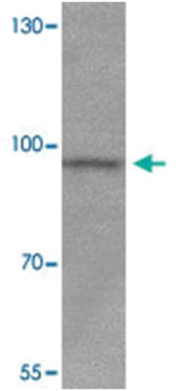JAKMIP2 Rabbit anti-Human, Mouse, Polyclonal Antibody, Abnova 100 &mu;g | Buy Online | Abnova | Fisher Scientific