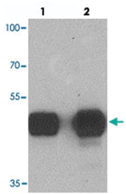 TUBA3C, Rabbit, Polyclonal Antibody, Abnova 100&mu;g; Unlabeled:Antibodies,