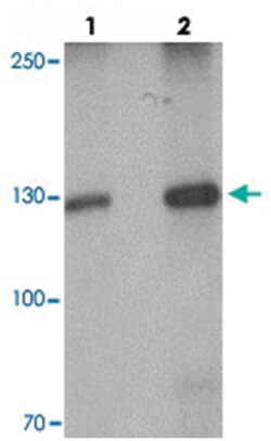 TYK2 Rabbit anti-Human, Mouse, Rat, Polyclonal Antibody, Abnova 100 &mu;g | Buy Online | Abnova Corporation | Fisher Scientific