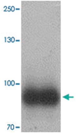 IL17RE Rabbit anti-Human, Mouse, Rat, Polyclonal Antibody, Abnova 100 &mu;g | Buy Online | Abnova Corporation | Fisher Scientific