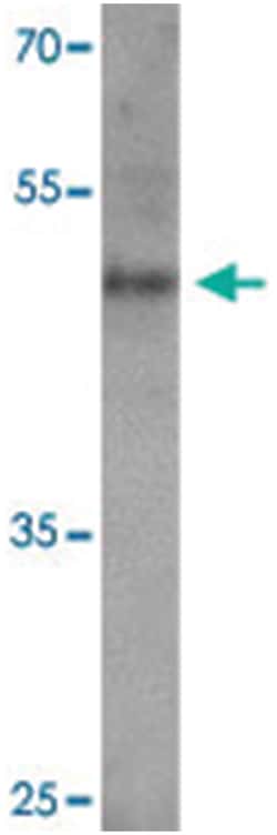BCL3 Rabbit anti-Human, Polyclonal Antibody, Abnova 100 &mu;g | Buy Online | Abnova Corporation | Fisher Scientific