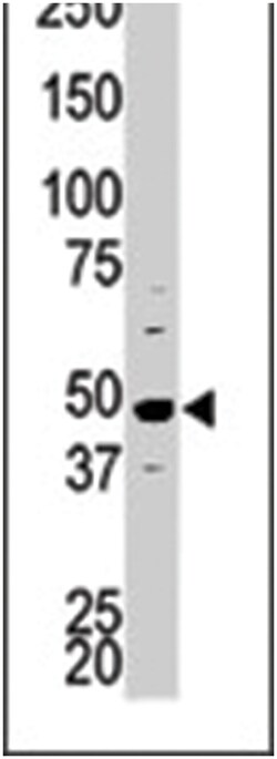 PCTK1 Rabbit anti-Human, Polyclonal Antibody, Abnova 400 &mu;L | Buy Online | Abnova | Fisher Scientific