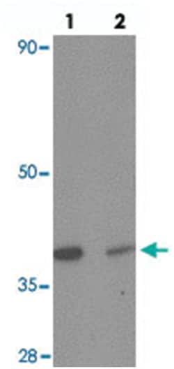 GPR44 Rabbit anti-Human, Mouse, Polyclonal Antibody, Abnova 100 &mu;g | Buy Online | Abnova Corporation | Fisher Scientific