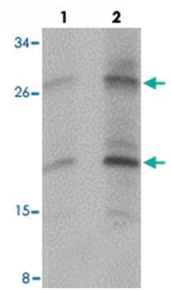 PDGFB Rabbit anti-Human, Mouse, Rat, Polyclonal Antibody, Abnova 100 &mu;g | Buy Online | Abnova Corporation | Fisher Scientific