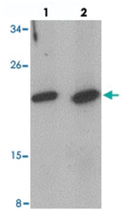 CCL2 Rabbit anti-Human, Mouse, Rat, Polyclonal Antibody, Abnova 100 &mu;g | Buy Online | Abnova Corporation | Fisher Scientific