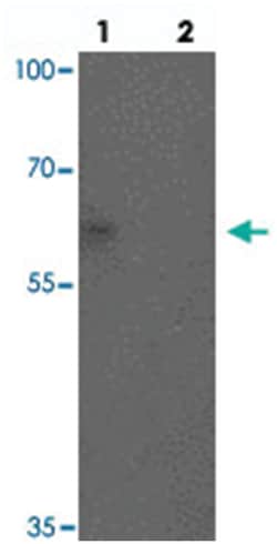 CARM1 Rabbit anti-Human, Mouse, Rat, Polyclonal Antibody, Abnova 100 &mu;g | Buy Online | Abnova Corporation | Fisher Scientific