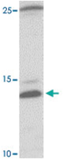 CCL4, Rabbit, Polyclonal Antibody, Abnova 100 &mu;g | Buy Online | Abnova Corporation | Fisher Scientific