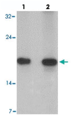 IL15 Rabbit anti-Human, Mouse, Rat, Polyclonal Antibody, Abnova 100 &mu;g | Buy Online | Abnova Corporation | Fisher Scientific