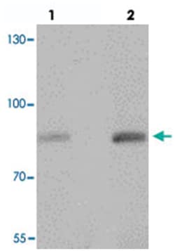 PIBF1, Rabbit, Polyclonal Antibody, Abnova 100 &mu;g | Buy Online | Abnova | Fisher Scientific