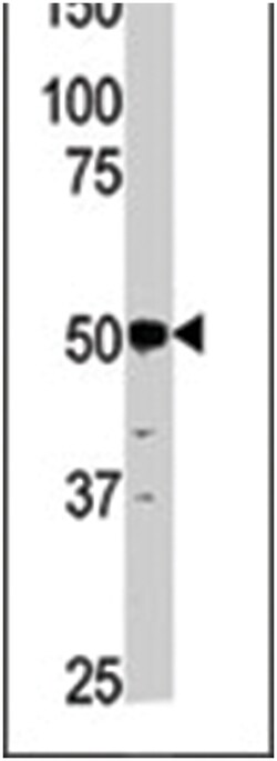 PGK2, Rabbit, Polyclonal Antibody, Abnova 400 &mu;L | Buy Online | Abnova Corporation | Fisher Scientific