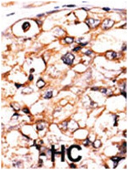 PGK2, Rabbit, Polyclonal Antibody, Abnova 400 &mu;L | Buy Online | Abnova Corporation | Fisher Scientific