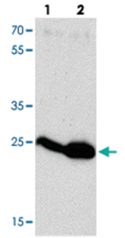 HIV-1 p24, Rabbit, Polyclonal Antibody, Abnova 100&mu;g; Unlabeled:Antibodies,