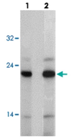 AGR2 Rabbit anti-Human, Mouse, Polyclonal Antibody, Abnova 100&mu;g; Unlabeled:Antibodies,
