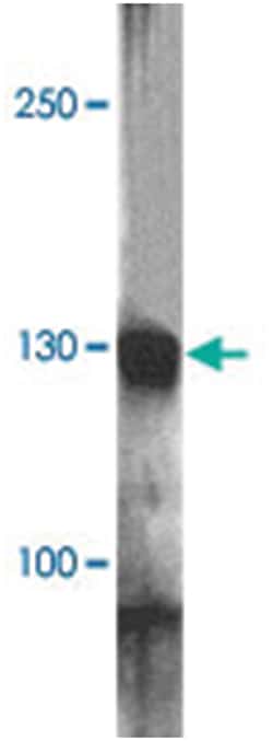 RC3H1 Rabbit anti-Human, Mouse, Rat, Polyclonal Antibody, Abnova 100&mu;g;