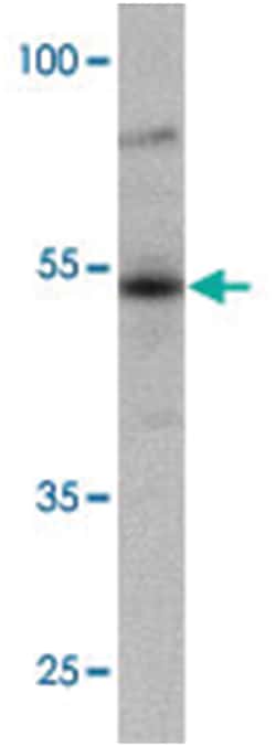 FOXA1 Rabbit anti-Human, Polyclonal Antibody, Abnova 100 &mu;g | Buy Online | Abnova Corporation | Fisher Scientific