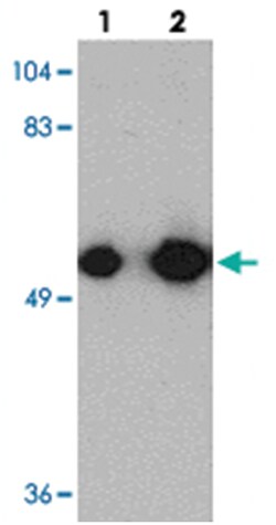 KREMEN1 Rabbit anti-Human, Mouse, Rat, Polyclonal Antibody, Abnova 100&mu;g;