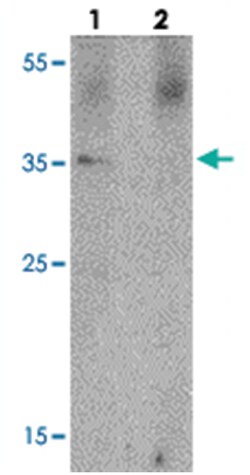PRKCDBP, Rabbit, Polyclonal Antibody, Abnova 100 &mu;g | Buy Online | Abnova Corporation | Fisher Scientific