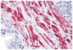 TBC1D4, Rabbit, Polyclonal Antibody, Abnova 100&mu;g; Unlabeled:Antibodies,